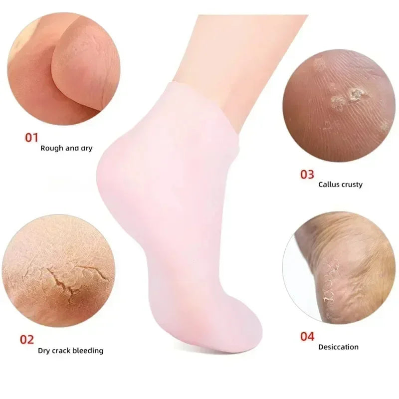 Cracked Heel Treatment Socks with Silicone Gel – Comfort & Repair