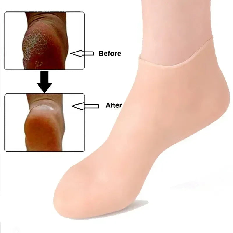Cracked Heel Treatment Socks with Silicone Gel – Comfort & Repair